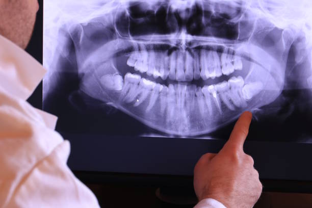 Best After-Hours Emergency Dentist in Mcdade, TX